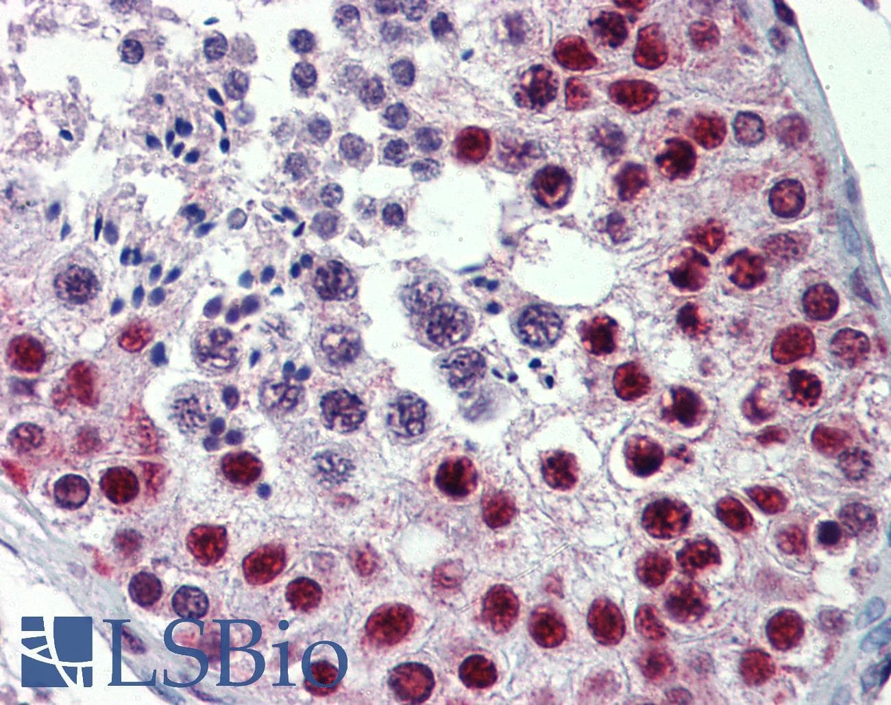 IHC-plus™ Polyclonal Rabbit anti-Human HDAC1 Antibody (IHC, IF, WB)