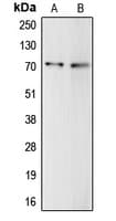 Complement C9 Antibody (Internal)