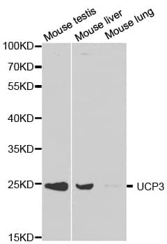 Polyclonal Rabbit anti-Human UCP3 Antibody (IHC, IF, WB)