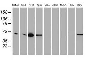 VASP Antibody (clone OTI1H8)