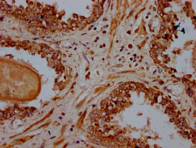 PSME4 / PA200 Antibody