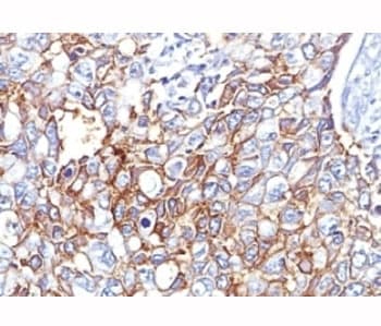 EPCAM Antibody (aa20-60, clone EGP40/826)