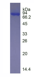 Human CEACAM5 / CD66e Protein (Recombinant His, N-Terminal)