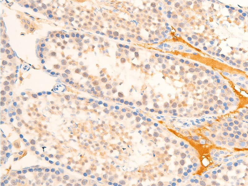 MAP3K7 / TAK1 Antibody (phospho-Thr187)
