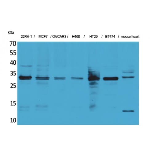 Polyclonal Rabbit anti-Human Latexin / MUM Antibody (90-170 aa, Internal, WB)