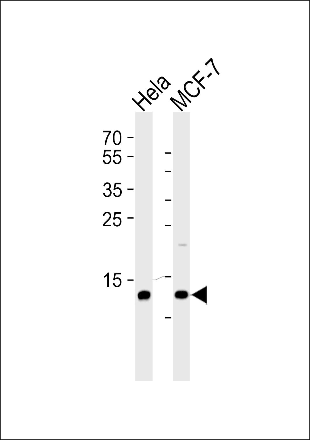 Polyclonal Rabbit anti-Human RBX1 / ROC1 Antibody (aa74-108, IHC, IF, WB)