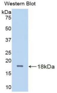 Beta-N-Acetylglucosaminidase Antibody (aa319-450)