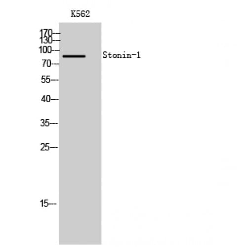 STON1 Antibody (660-740 aa, C-terminal)