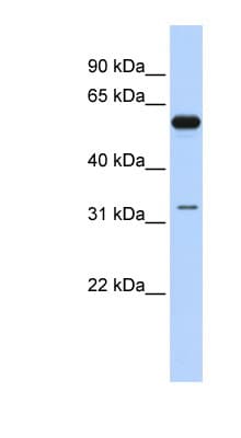 DDX28 Antibody (aa107-156)