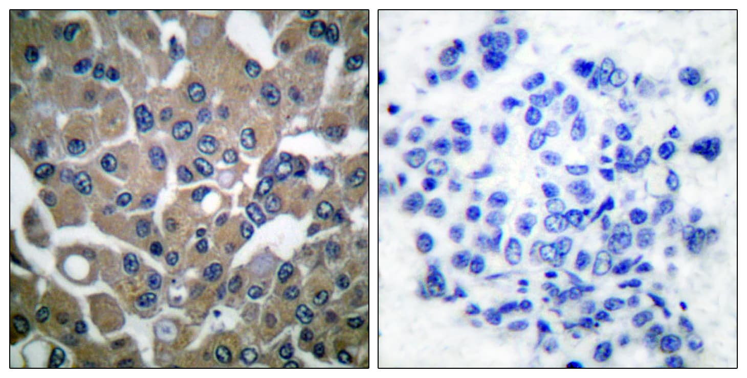 Polyclonal Rabbit anti-Human PLCG1 Antibody (phospho-Tyr783, IHC, WB)