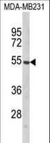 PTAR1 Antibody (aa60-89)