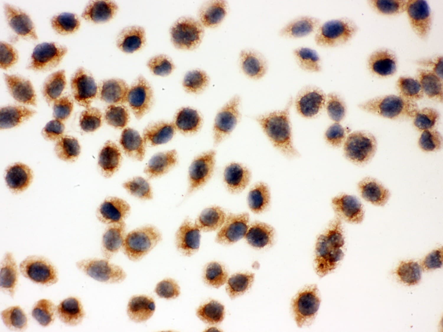 Polyclonal Rabbit anti-Human CYCS / Cytochrome c Antibody (aa2-105, IHC, WB)