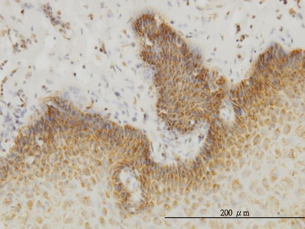 INSRR Antibody (clone 6E6)