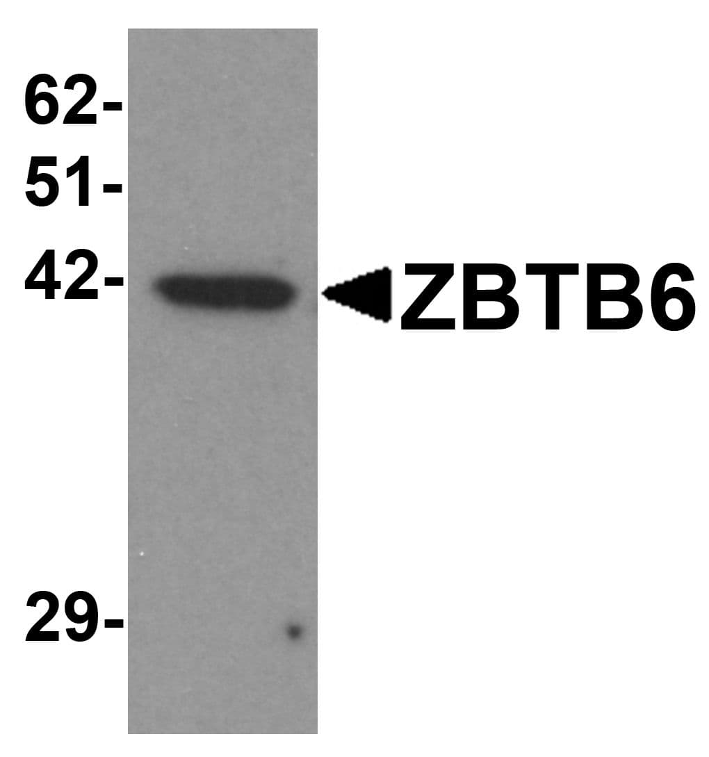 IHC-plus™ ZBTB6 Antibody