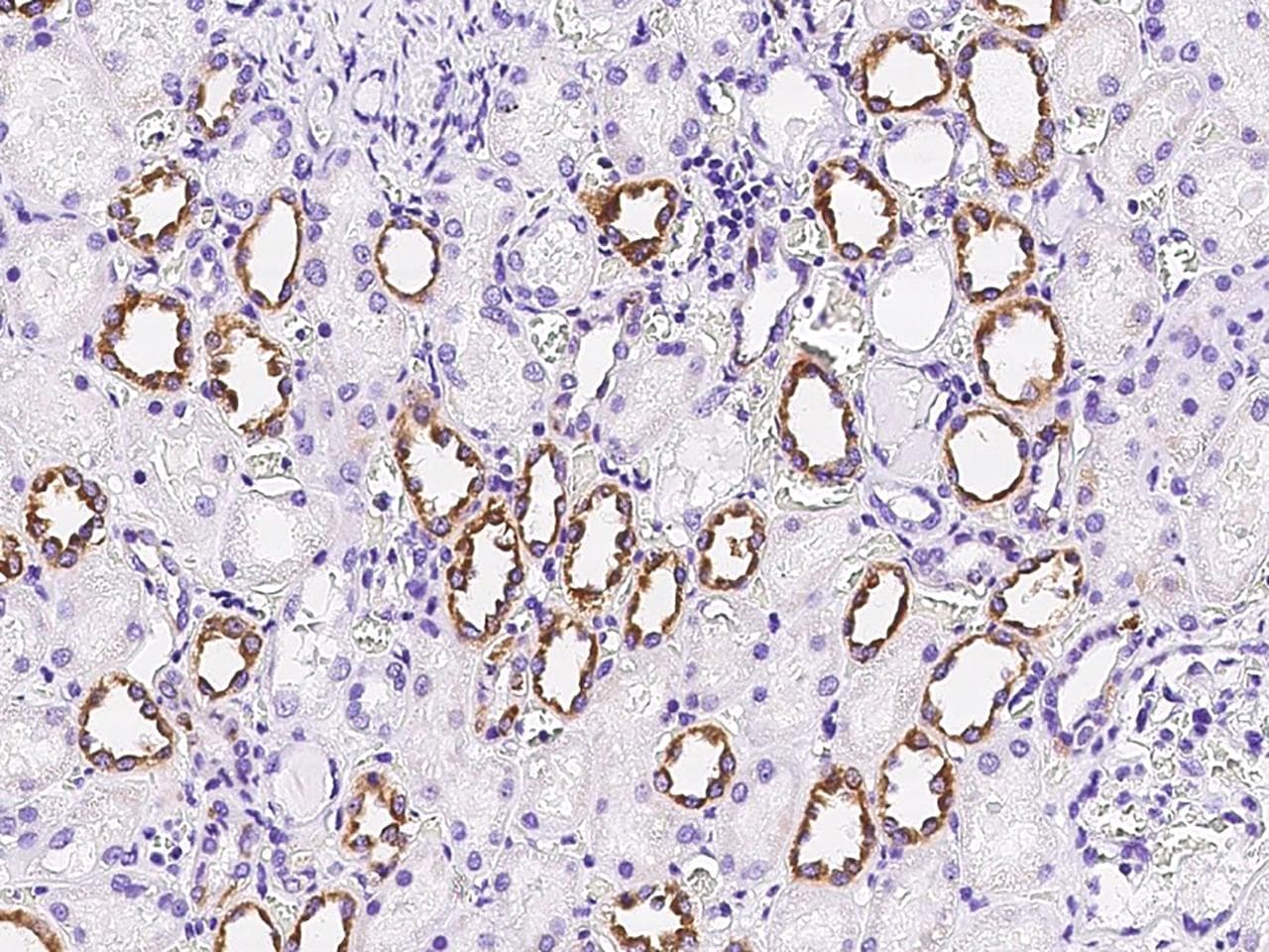 FGD2 Antibody