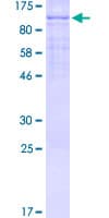 Human EML1 / EMAP Protein (Recombinant GST)