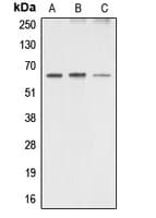 PRKAA1 + PRKAA2 Antibody (Internal)