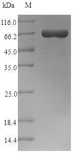 Clostridium perfringens Perfringolysin O Protein (Recombinant 6His-SUMO, N-terminus)