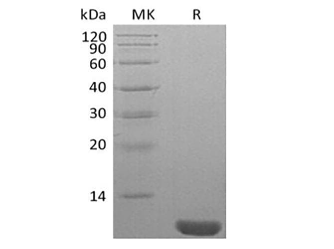 Human NEDD8 Protein (Recombinant)