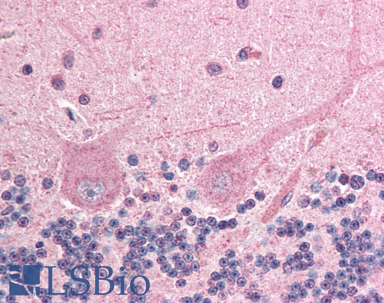 IHC-plus™ ING4 Antibody (aa150-175)