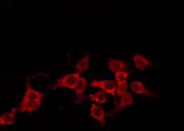 IHC-plus™ Polyclonal Rabbit anti-Human CTSD / Cathepsin D Antibody (IHC, IF, WB)