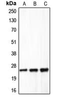 CLDN5 / Claudin 5 Antibody (C-Terminus)