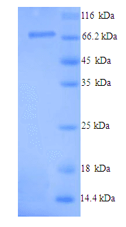Human PADI1 Protein (Recombinant His)