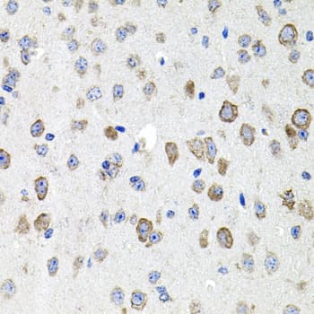 CDH23 / Cadherin 23 Antibody