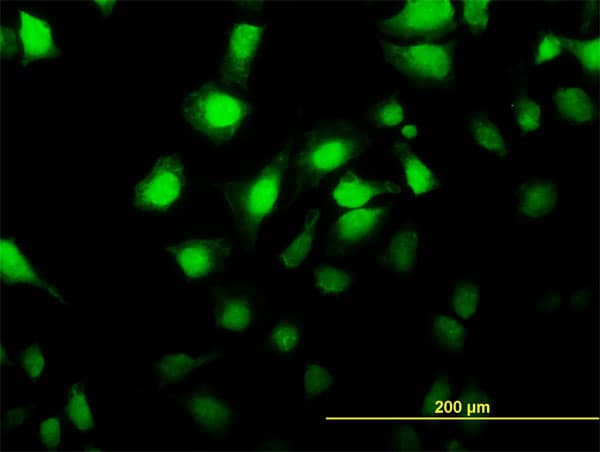 MKNK2 / MNK2 Antibody (clone 4F11)
