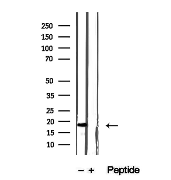 GMF Beta / GMFB Antibody