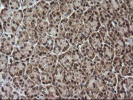 RTKN / Rhotekin Antibody (clone OTI2E9)