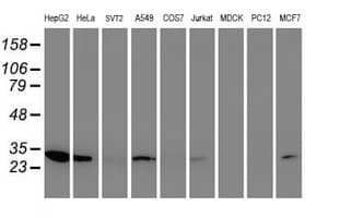 NUBPL Antibody (aa1-250, clone OTI5F8)