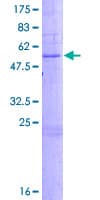 Human C6orf25 Protein (Recombinant GST)