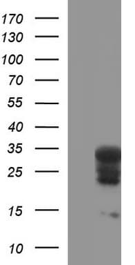 Monoclonal Mouse anti-Human HSCB Antibody (clone OTI3E1, IHC, WB)