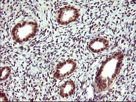 Monoclonal Mouse anti-Human UPRT Antibody (clone OTI1C9, IHC, WB)