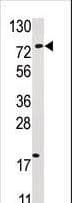 USP16 Antibody (aa386-416)