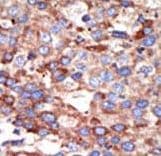 YY1 Antibody (aa268-297)