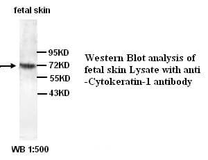IHC-plus™ KRT1 / CK1 / Cytokeratin 1 Antibody (Internal)