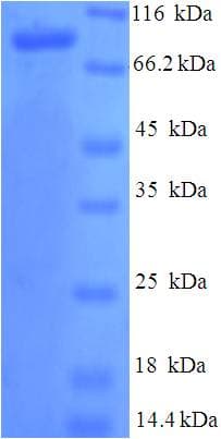 Human PROS1 / Protein S (Recombinant His-SUMO)