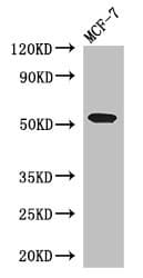 PSEN1 / Presenilin 1 Antibody