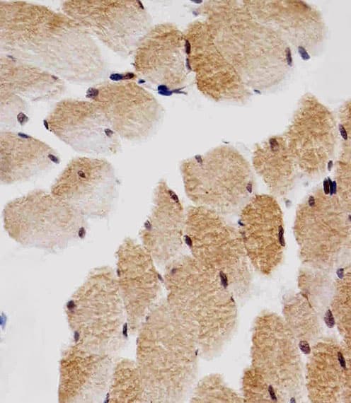 CDKN1B / p27 Kip1 Antibody (clone 1373CT407.103.103)