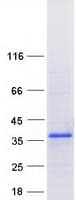Human ZFAND2B Protein (Recombinant Myc-DDK (Flag))