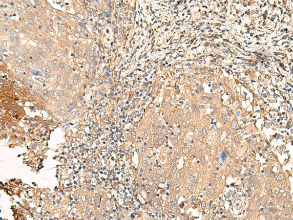 Polyclonal Rabbit anti-Human GALR2 / Galanin Receptor 2 Antibody (IHC)