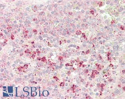 IHC-plus™ SEMA3E / Semaphorin 3E Antibody