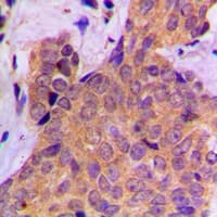 CTTN / Cortactin Antibody (phospho-Tyr421)
