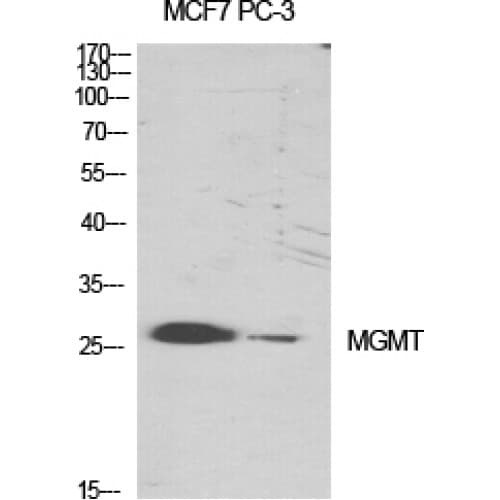 Polyclonal Rabbit anti-Human MGMT Antibody (1-80 aa, N-terminal, IHC, WB)