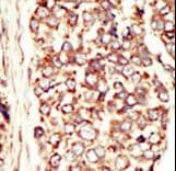 Polyclonal Rabbit anti-Human ERBB2 / HER2 Antibody (aa21-52, IHC, WB)
