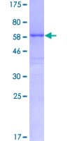 Human HHEX / HEX Protein (Recombinant GST)