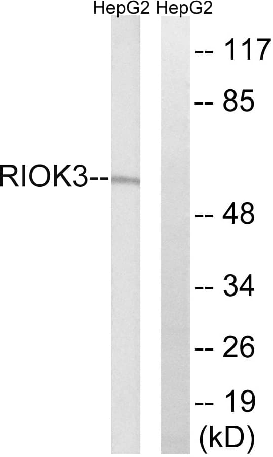 RIOK3 Antibody (aa271-320)