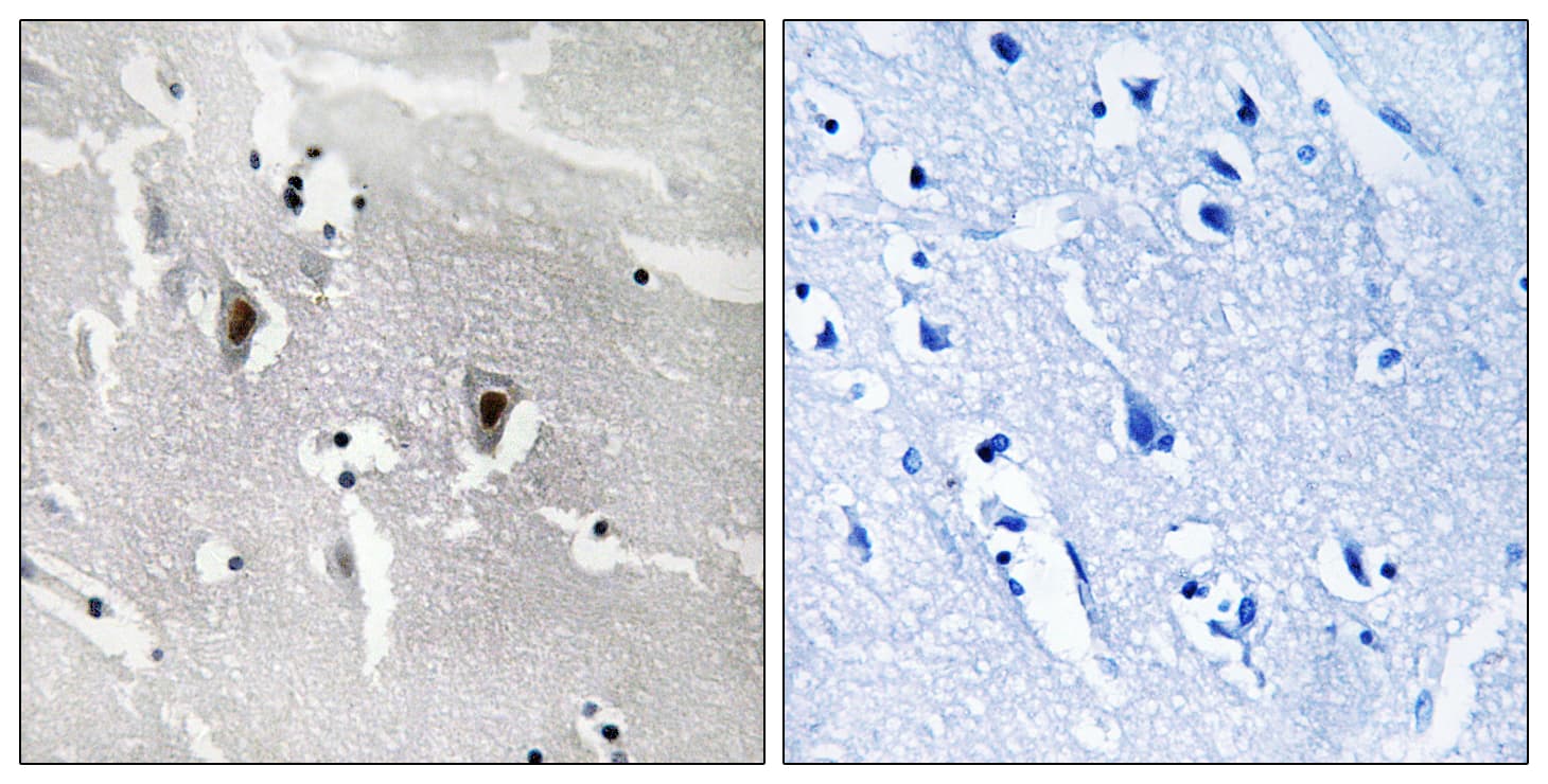 Polyclonal Rabbit anti-Human RBM6 / 3G2 Antibody (aa991-1040, IHC, IF, WB)